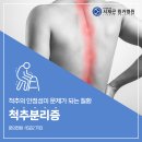 송파 척추수술병원에서 알려드리는 척추분리증 이미지