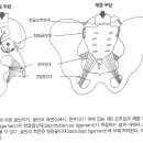 골반외상 이미지