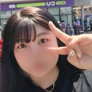 짝짝쓰 | 애교살 필러 리얼후기｜시술 전후 변화와 만족도