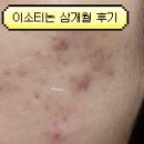 삼쪽 | 이소티논/트레인(여드름약) 부작용,복용법,효과,삼개월 후기