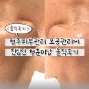 엄마의 청춘 | 청주피부관리, 모공관리에 진심인 청춘미남 솔직후기
