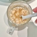 경화 대 반점 | 흉부통증 협심증 증상 및 관리했던 노하우 공개