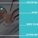 스티치킹콩 이미지