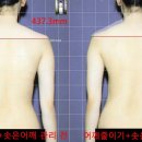 솟은어깨+어깨줄이기 관리로 여자넓은어깨가 줄어요^^ 이미지