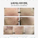 행복한피부사랑