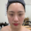 타라 | 성북구 피부관리 타라테라피 맞춤 관리 후기