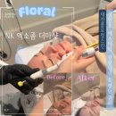NK빌딩 | 대전둔산동 피부관리 유명한 곳 플로럴스킨 NK엑소좀더마샷후기 대전피부관리추천
