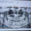 서울플란트원치과의원 이미지