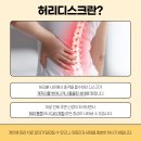 전주우리병원 | 논산에서 허리디스크 치료받으러 전주우리병원 찾는 이유