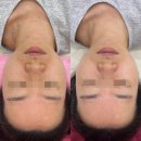 장유3동행정복지센터(2826)? | 에그뷰티: 장유피부관리 에그뷰티 스케일러 필링 후기, 율하 피부관리 맛집, 라라필 후기