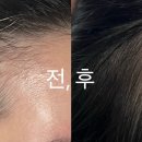 샤크존헤어