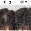 무성약국 | 여자 가르마 탈모 정수리 탈모 초기 가르마커버 관리 후기