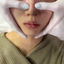 피부러움 | 피부러움 합정점 | 러움윤곽케어 | 윤곽+볼륨+결 토탈케어 받은 후기