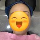 💆‍♀️ 블리비의원 일산점 내돈내산 후기_슈링크, 인모드, 아큐주사, 토닝레이저, 비타민관리