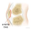 원영상의학과의원(The One MRI Clinic) | 30대 여성 무릎 아작나서 MRI 찍은 후기와 가격 (부제: 연골을 소중히)