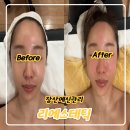 리메디컬 | 해운대 웨딩관리 잘하는곳, 리 에스테틱 내돈내산 후기