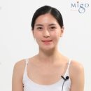 미고성형외과 | 미고성형외과 매부리코 성형후기
