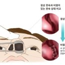 참부부한의원 이미지