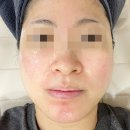 1318. 길음역 3번 출구 뒤 | 수지 피부관리 물광관리 제대로 받고 온 용인 성복역 애몽스킨케어 후기