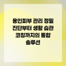 이레미용재료 | 용인피부 관리 정밀 진단부터 생활 습관 코칭까지의 통합 솔루션
