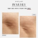 베이케어