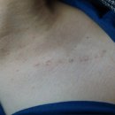 라인5차 이미지