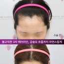 모앤라인성형외과의원 네이버블로그