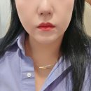 원더핏 | 강남 볼살 이중턱 지방분해주사 내돈내산 원더핏 리얼 후기 3회차