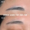 [내돈내산] 마곡 마리미뷰티 눈썹 문신 제거 후기 (feat. 9년차 문신 제거... 직장인분들 오세요...