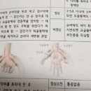 성인-징후2 프린트-순환-동맥부전증에서 척골 동맥 요골동맥 떼는 위치요~ 이미지