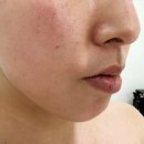 샤넬토탈뷰티 | 잠실웨딩관리 | 속건조 싹 잡아주는 프롬미 잠실점 샤넬물광필 후기