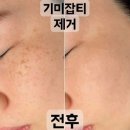 메리뷰티
