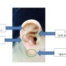 귀를 통한 건강관리 이미지
