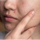 아름다운피부 이미지