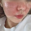 리멤버피부과의원 양주옥정 이미지