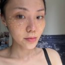 역삼약국 | 역삼역피부과 편평사마귀제거 색소제거 다빼자 내돈내산 후기 비포애프터 사진 있음