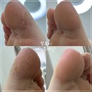 참뷰티(참-뷰티)