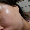 라온메디 | 라온메디 멜라스마 케어 크림 2주 찐사용 후기