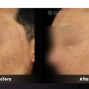 스노우의원 이미지