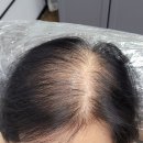 블랭크유전주반월점