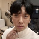 청담제이더마의원 | 피부 줄기세포주사 바우스에서 남자 피부관리