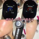 Lee스킨케어 | 셀비전 쎄라쥬 올인원 디바이스로 홈케어 루틴 4주차 후기! 턱살,볼패임 고민이신 분들 들어오세요!!
