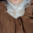 하나메디원 | 성남 점제거 저렴한 곳 수진역 메디원의원 편평사마귀 내돈내산 후기