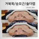레젤스킨 & 바디