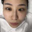 아이이뽀 | [안산 초지동 피부관리] 여드름관리 와 꿀피부를 원한다면 무조건 아이이뽀테오트리 안산점