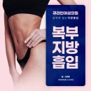 큐라인 네이버블로그