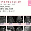 성성조은내과의원 이미지