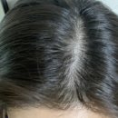 헤어온의원 이미지