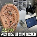 토브힐링스킨테라피 | 대구 칠성동 스킨730 이어테라피 아로마테라피 힐링관리 후기