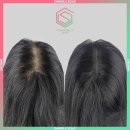 오직 스칼프 이미지